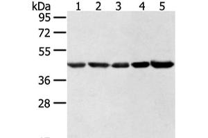 Western blot analysis of Hela lncap NIH/3T3 K562 and 231 cell using WDR77 Polyclonal Antibody at dilution of 1:500 (WDR77 anticorps)