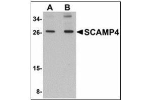Western blot analysis of SCAMP4 in 3T3 cell lysate with SCAMP4 antibody at (A) 1 and (B) 2 µg/ml. (SCAMP4 anticorps  (C-Term))