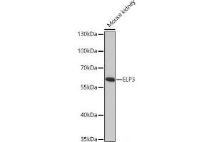 Western blot analysis of extracts of Mouse kidney using ELP3 Polyclonal Antibody at dilution of 1:1000.