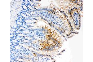 IHC analysis of Caspase-3 (P17)using anti- Caspase-3 (P17)antibody . (Caspase 3 anticorps  (N-Term))