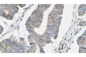 ABIN6276563 at 1/100 staining Human prostate tissue by IHC-P. (ACTN1 anticorps  (N-Term))