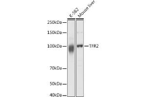 Western blot analysis of extracts of various cell lines, using TFR2 antibody (ABIN6128863, ABIN6149063, ABIN6149064 and ABIN6225172) at 1:1000 dilution. (Transferrin Receptor 2 anticorps  (AA 582-801))