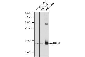 anti-Mitochondrial Ribosomal Protein L51 (MRPL51) (AA 1-128) antibody
