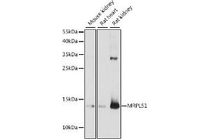 Western blot analysis of extracts of various cell lines, using MRPL51 antibody (ABIN7268577) at 1:1000 dilution. (MRPL51 anticorps  (AA 1-128))