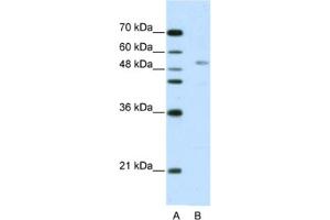 Western Blotting (WB) image for anti-G-Rich RNA Sequence Binding Factor 1 (GRSF1) antibody (ABIN2462114) (GRSF1 anticorps)