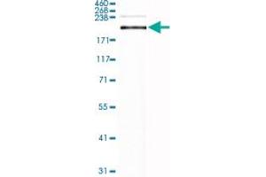 Western Blot analysis of human lung tissue lysate with LAMB2 monoclonal antibody, clone CL2976 . (LAMB2 anticorps)