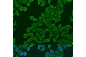 Immunofluorescence analysis of U2OS cells using RPL36 Polyclonal Antibody at dilution of 1:100.