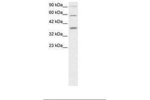 Image no. 2 for anti-PRKC, Apoptosis, WT1, Regulator (PAWR) (AA 166-215) antibody (ABIN6735796) (PAWR anticorps  (AA 166-215))