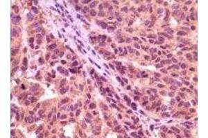 Immunohistochemistry (IHC) image for anti-Glycogen Synthase Kinase 3 alpha (GSK3a) (truncated) antibody (ABIN2464059)