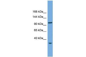 WB Suggested Anti-CHTF18 Antibody Titration: 0. (CTF18 anticorps  (Middle Region))