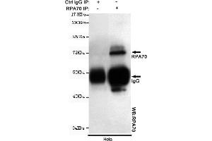 Immunoprecipitation analysis of Hela cell lysates using R mouse mAb.