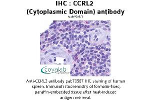 Image no. 1 for anti-Chemokine (C-C Motif) Receptor-Like 2 (CCRL2) (3rd Cytoplasmic Domain) antibody (ABIN1732793) (CCRL2 anticorps  (3rd Cytoplasmic Domain))