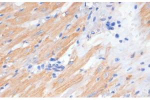 Immunohistochemistry of paraffin-embedded Rat heart using PDCD2L Polyclonal Antibody at dilution of 1:100 (40x lens).