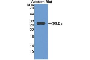 Western blot analysis of the recombinant protein. (IGFBP4 anticorps  (AA 23-259))