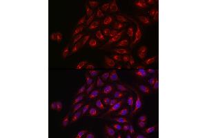 Immunofluorescence analysis of U2OS cells using TLR1 Rabbit pAb (ABIN3023654, ABIN3023655, ABIN3023656 and ABIN6214092) at dilution of 1:50 (40x lens). (TLR1 anticorps  (AA 30-290))