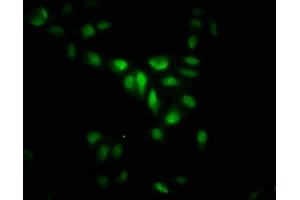 Immunofluorescence staining of Hela cells with ABIN7158992 at 1: 266, counter-stained with DAPI. (MAPKAP Kinase 5 anticorps  (AA 200-471))