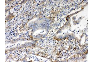 IHC analysis of CD151 using anti- CD151 antibody . (CD151 anticorps  (AA 113-175))