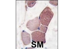 Formalin-fixed and paraffin-embedded human skeletal muscle tissue reacted with UCHL3 Antibody (C-term) (ABIN1882147 and ABIN2839167) , which was peroxidase-conjugated to the secondary antibody, followed by DAB staining. (UCHL3 anticorps  (C-Term))