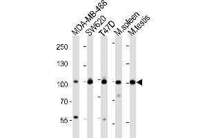 Western blot analysis of lysates from MDA-MB-468, S, T47D cell line, mouse spleen, mouse testis tissue (from left to right), using EZH2 Antibody (ABIN650707 and ABIN2839280).