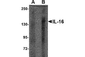 Western Blotting (WB) image for anti-Interleukin 16 (IL16) (N-Term) antibody (ABIN1031693)