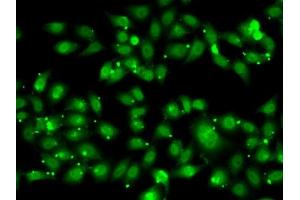 Immunofluorescence analysis of MCF7 cells using NR2C1 antibody (ABIN6128389, ABIN6144809, ABIN6144810 and ABIN6222379). (NR2C1 anticorps  (AA 1-240))