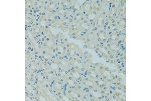 Immunohistochemistry of paraffin-embedded mouse kidney using MBD2 antibody.