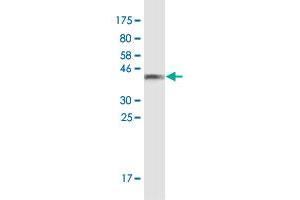 Western Blot detection against Immunogen (35. (TJP3 anticorps  (AA 868-952))
