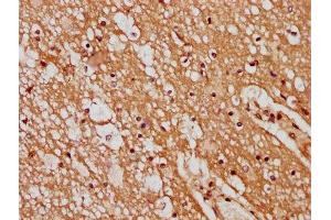IHC image of ABIN7165614 diluted at 1:400 and staining in paraffin-embedded human brain tissue performed on a Leica BondTM system. (GPR17 anticorps  (AA 151-262))