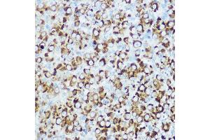 Immunohistochemistry of paraffin-embedded rat ovary using RSPO1 Rabbit pAb (ABIN6132958, ABIN6147279, ABIN6147280 and ABIN6224304) at dilution of 1:100 (40x lens). (RSPO1 anticorps  (AA 21-263))