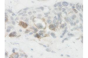 Image no. 2 for anti-Nephroblastoma Overexpressed (NOV) antibody (ABIN465355) (NOV anticorps)
