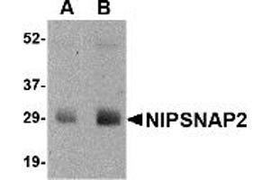 Western Blotting (WB) image for anti-Glioblastoma Amplified Sequence (GBAS) (N-Term) antibody (ABIN1031480)