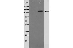 Western blot analysis on HuvEc cell lysate using FIR Antibody,The lane on the left is treated with the antigen-specific peptide. (FARP2 anticorps  (Internal Region))