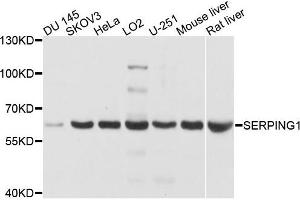 Western blot analysis of extracts of various cells, using SERPING1 antibody. (SERPING1 anticorps)