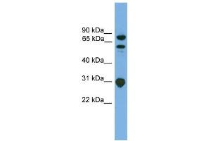 WB Suggested Anti-SH3KBP1 Antibody Titration: 0. (SH3KBP1 anticorps  (N-Term))