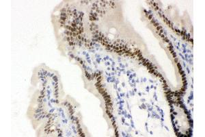 Anti-VDR Picoband antibody, IHC(P) IHC(P): Mouse Intestine Tissue