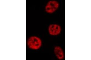 ABIN6277665 staining HepG2 by IF/ICC. (CREM anticorps  (Internal Region))