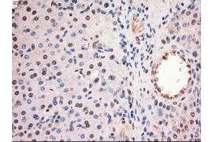 Image no. 5 for anti-Myc Proto-Oncogene protein (MYC) antibody (ABIN1497013) (c-MYC anticorps)
