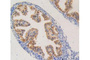 Used in DAB staining on fromalin fixed paraffin- embedded spermaduct tissue