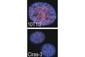 Indirect immunofluorescence analysis showed that RPS6KA4 is predominantly localized in the nucleus of parental (10T1/2) and oncogene-transformed (Ciras-3) mouse fibroblasts . (MSK2 anticorps  (C-Term))