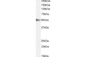 (ABIN185463) (2 μg/mL) staining of Human Tonsil lysate (35 μg protein in RIPA buffer). (HRH2 anticorps  (C-Term))