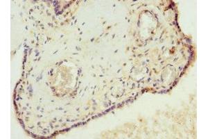 Immunohistochemistry of paraffin-embedded human placenta tissue using ABIN7175638 at dilution of 1:100 (VHLL anticorps  (AA 1-139))