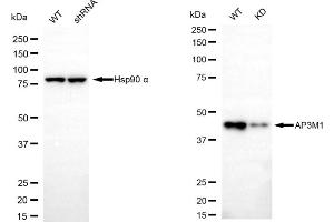 Western blotting analysis using AP3M1 antibody (ABIN7797512).