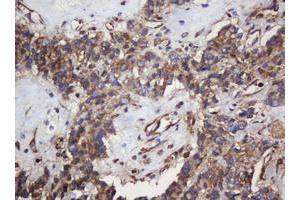 Image no. 1 for anti-SERPINE1 mRNA Binding Protein 1 (SERBP1) (AA 1-262) antibody (ABIN1490675)