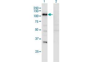 Western Blot analysis of SECISBP2 expression in transfected 293T cell line by SECISBP2 monoclonal antibody (M08), clone 3A7. (SECISBP2 anticorps  (AA 106-205))