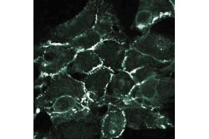 Immunofluorescent staining of 293 cells with anti-N-Cadherin. (N-Cadherin anticorps  (AA 802-819))