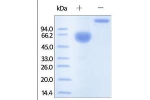 Human PROCR, Fc Tag on SDS-PAGE under reducing (R) and no-reducing (NR) conditions.