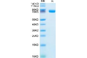 Human IL-1 RII on Tris-Bis PAGE under reduced condition. (IL1R2 Protein (AA 14-343) (Fc Tag))