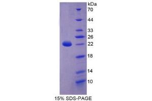 SDS-PAGE (SDS) image for Keratin 18 (KRT18) (AA 1-159) protein (His tag) (ABIN2125553) (Cytokeratin 18 Protein (AA 1-159) (His tag))