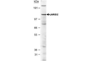 Western Blotting (WB) image for anti-Jumonji, AT Rich Interactive Domain 2 (JARID2) (AA 1-100), (N-Term) antibody (ABIN1951845) (JARID2 anticorps  (N-Term))