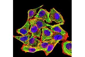 Immunofluorescence analysis of Hela cells using CD45R mouse mAb (green).